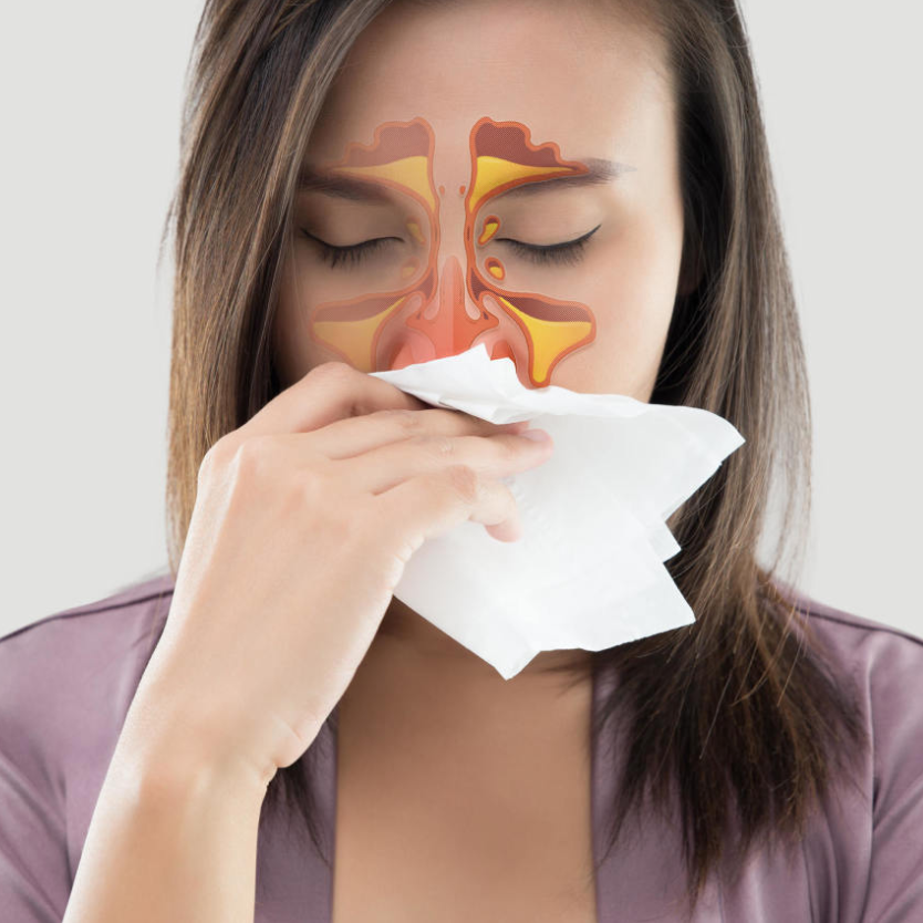 Photothérapie nasale : efficace contre les allergies ?